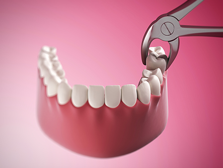The image features a pair of scissors cutting through a set of teeth with a close-up view of the dental work being performed on a red background.
